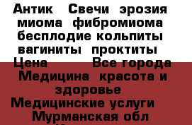 Антик.  Свечи (эрозия, миома, фибромиома, бесплодие,кольпиты, вагиниты, проктиты › Цена ­ 550 - Все города Медицина, красота и здоровье » Медицинские услуги   . Мурманская обл.,Кировск г.